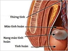 Ảnh Viêm tinh hoàn - 4