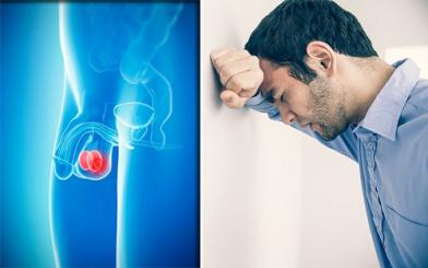 Tổng quan về bệnh viêm tinh hoàn