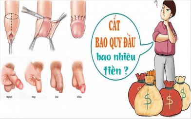 Chi phí cắt bao quy đầu là bao nhiêu tiền trong năm 2018