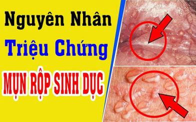 Nguyên nhân gây mụn rộp sinh dục