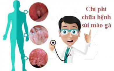 Chi phí chữa sùi mào gà hết bao nhiêu tiền?