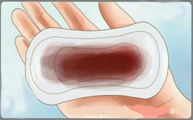 Không nên chủ quan khi thấy hiện tượng ra dịch màu nâu sau kỳ kinh 