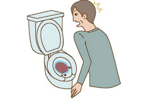 Bệnh tiểu ra máu