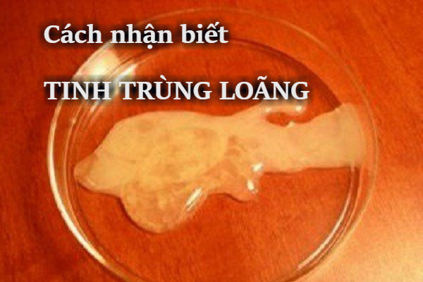 Cách nhận biết tinh trùng loãng