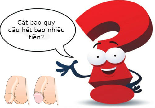 Chi phí cắt bao quy đầu Hà Nội 