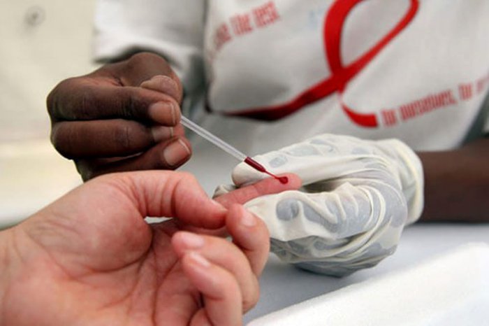 Chi phí xét nghiệm HIV hết bao tiền