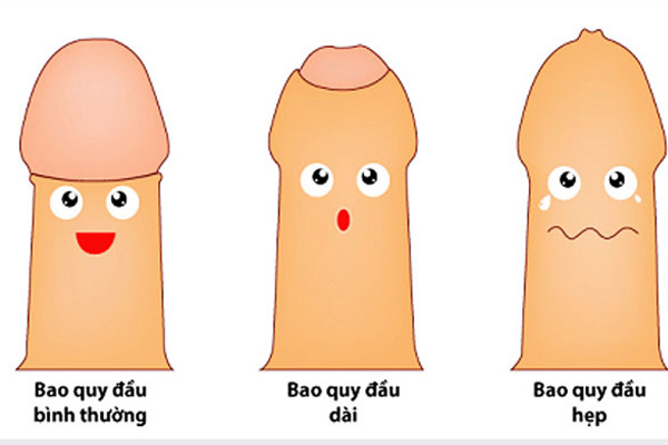 Dài bao quy đầu