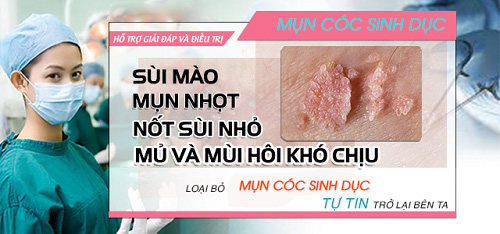Điều trị mụn cóc sinh dục