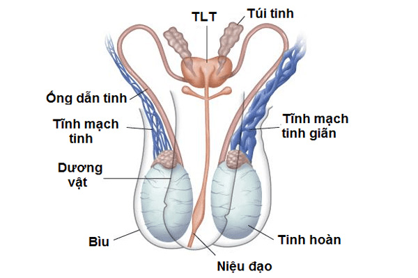 Giãn tĩnh mạch thừng tinh