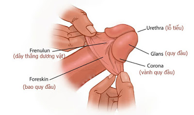 Nguyên nhân đứt dây hãm bao quy đầu