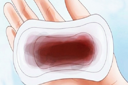 Nguyên nhân khí hư màu nâu