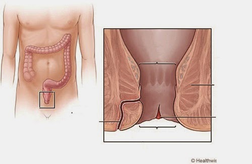 Nứt kẽ hậu môn