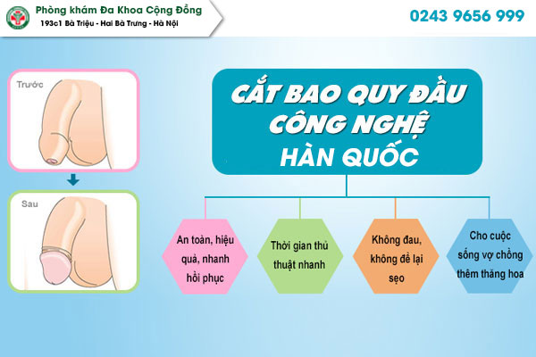 Phương pháp cắt bao quy đầu
