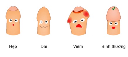 Tại sao phải cắt bao quy đầu