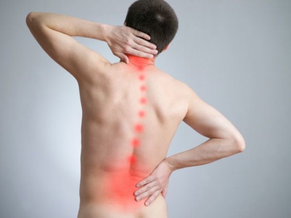 Thoát vị đĩa đệm là nguyên nhân gây sa tinh hoàn 