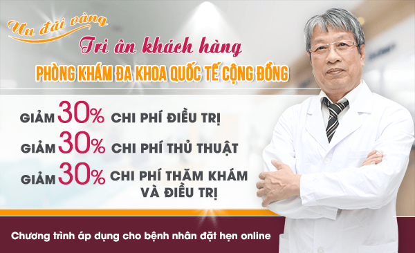 Ưu đãi giảm chi phí