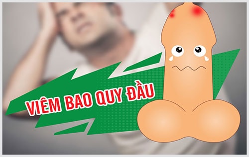Bệnh viêm bao quy đầu