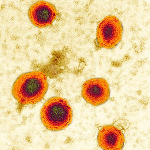Virus quai bị gây viêm tinh hoàn