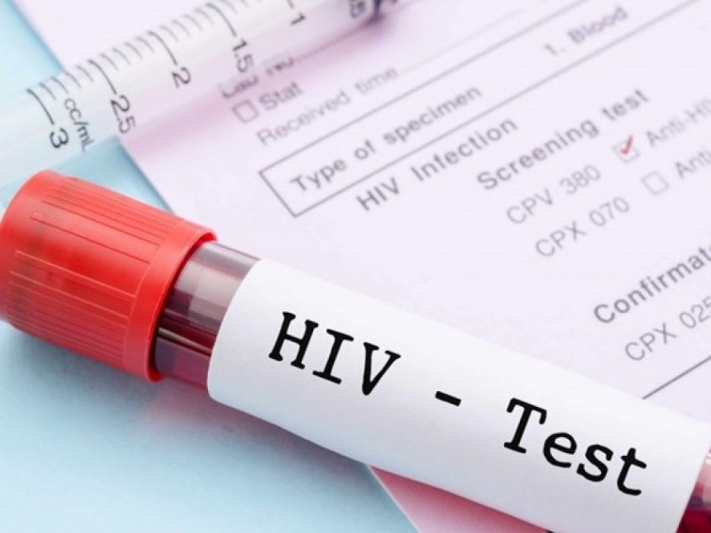 Xét nghiệm bệnh HIV 